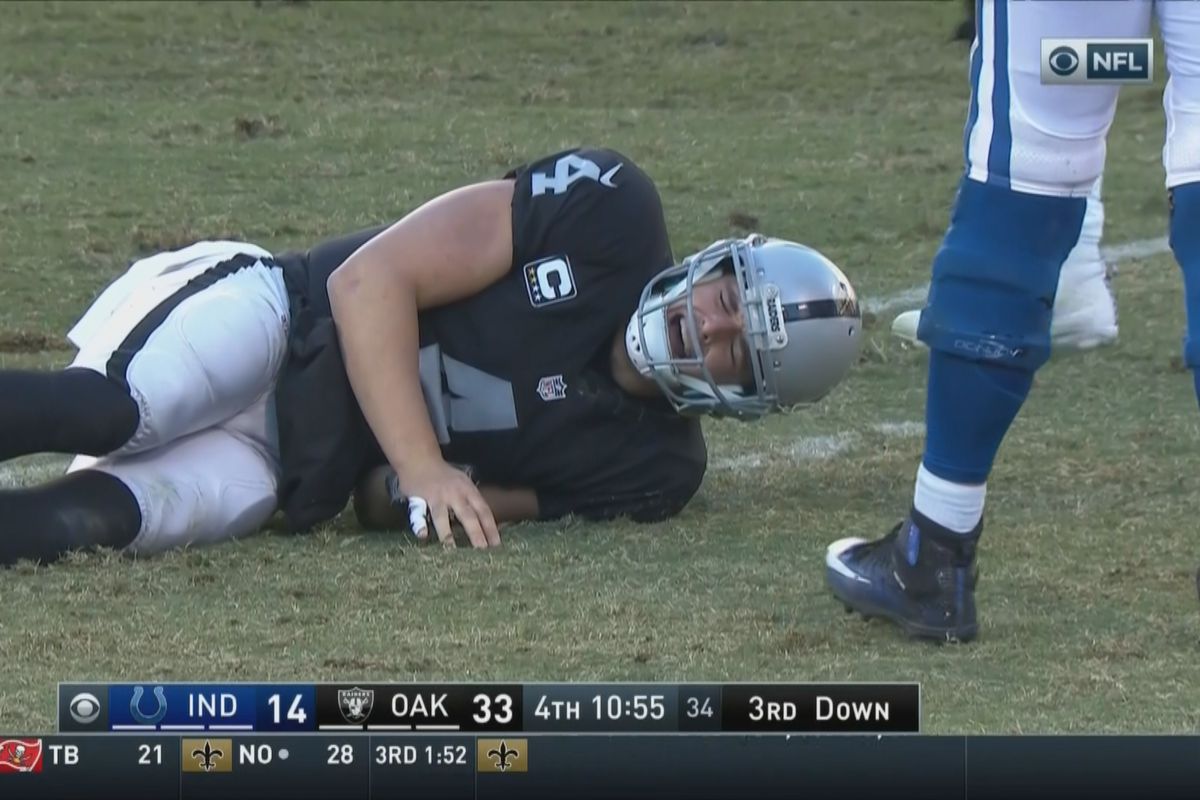 Report: Derek Carr is losing the confidence of his teammates possibly because he’s a cryer